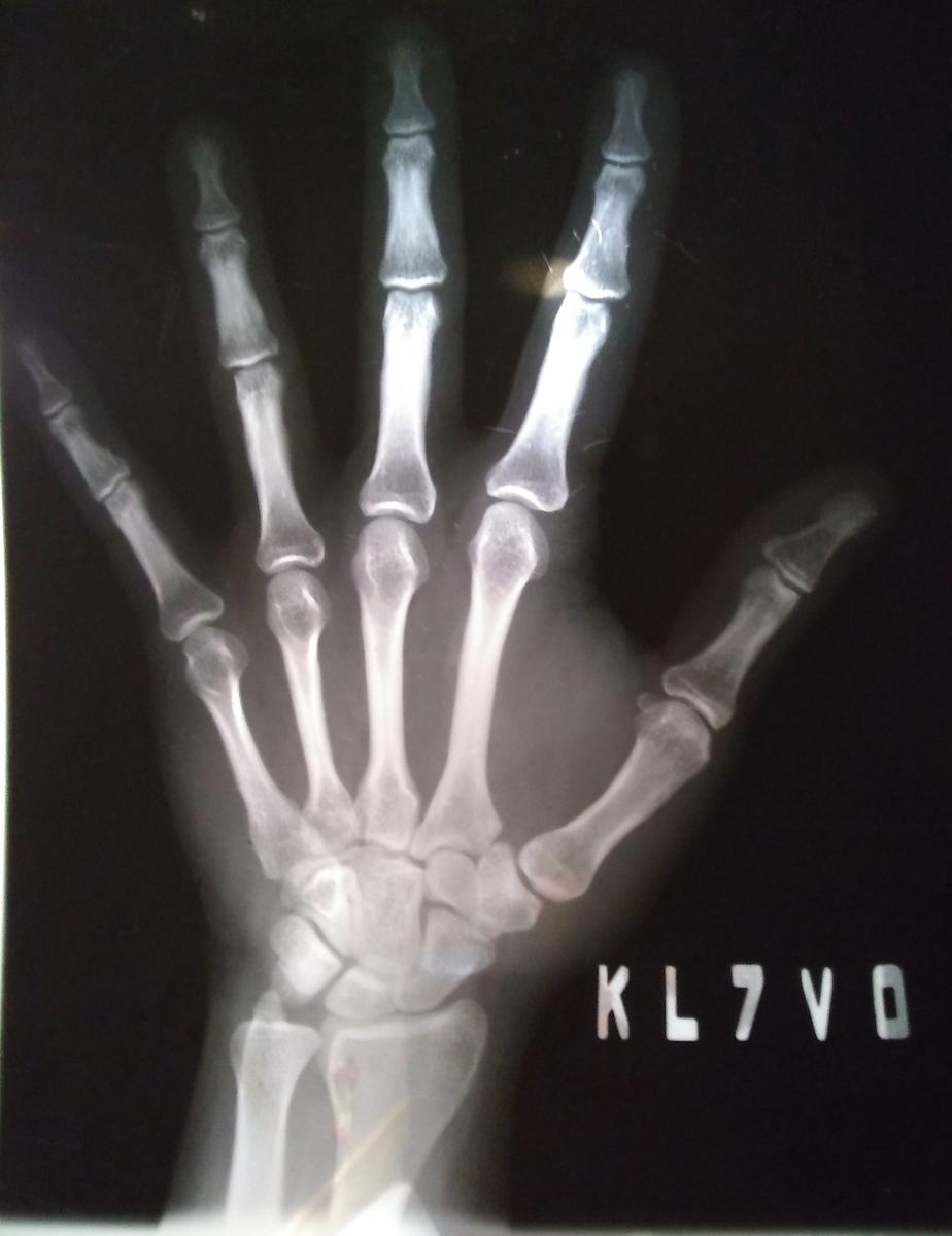 Primary Image for KL7VO